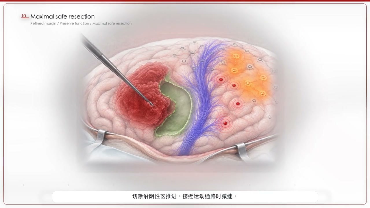 BrainMed 公开会议