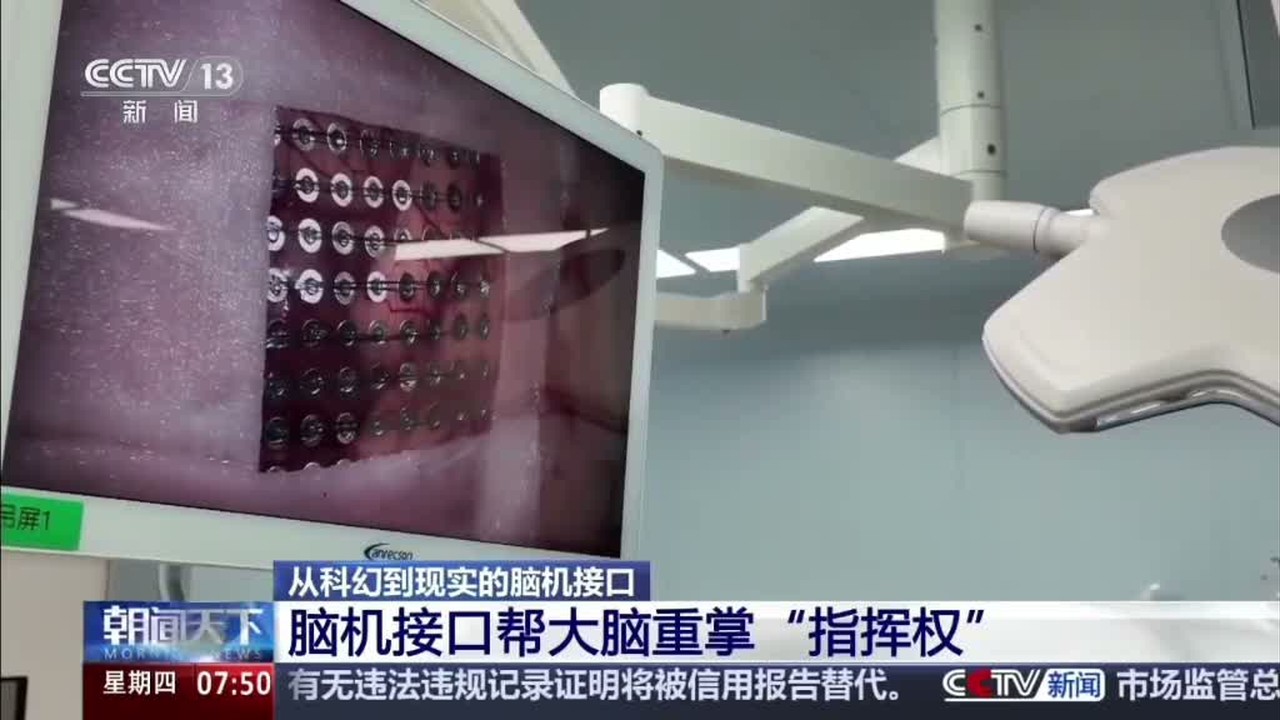 央视新闻报道华西医院脑肿瘤手术中应用脑机接口
